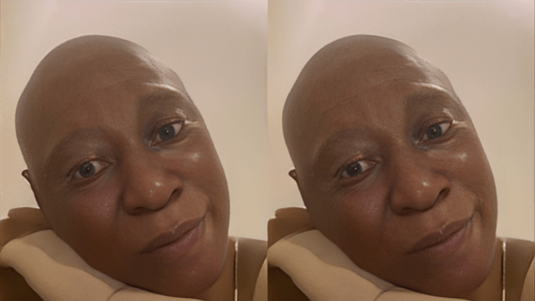 Cynthia Anijekwu appealing for financial support to cover her ₦600,000 monthly cancer treatment after the disease spread to her bones.